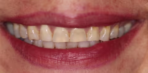 Before Image