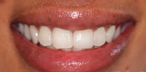 After Image